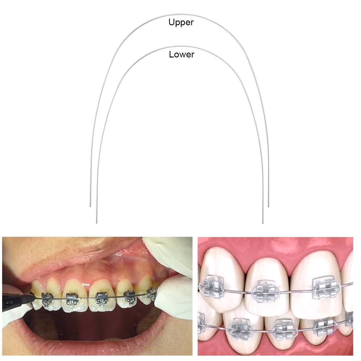 AZDENT Dental Orthodontic Stainless Steel Rectangular Arch Wires Natural Form