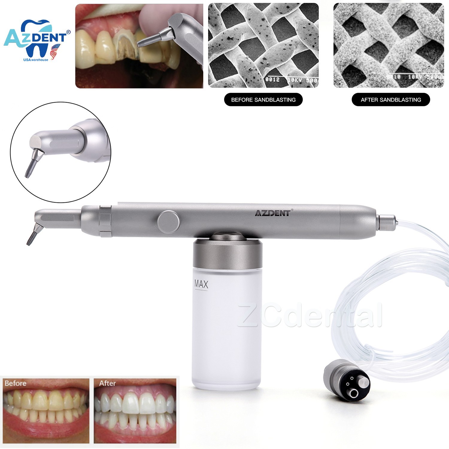 Abrasión Dental Aire Pulidor óxido de Aluminio Micro Blaster Agua Spray 4Agujero