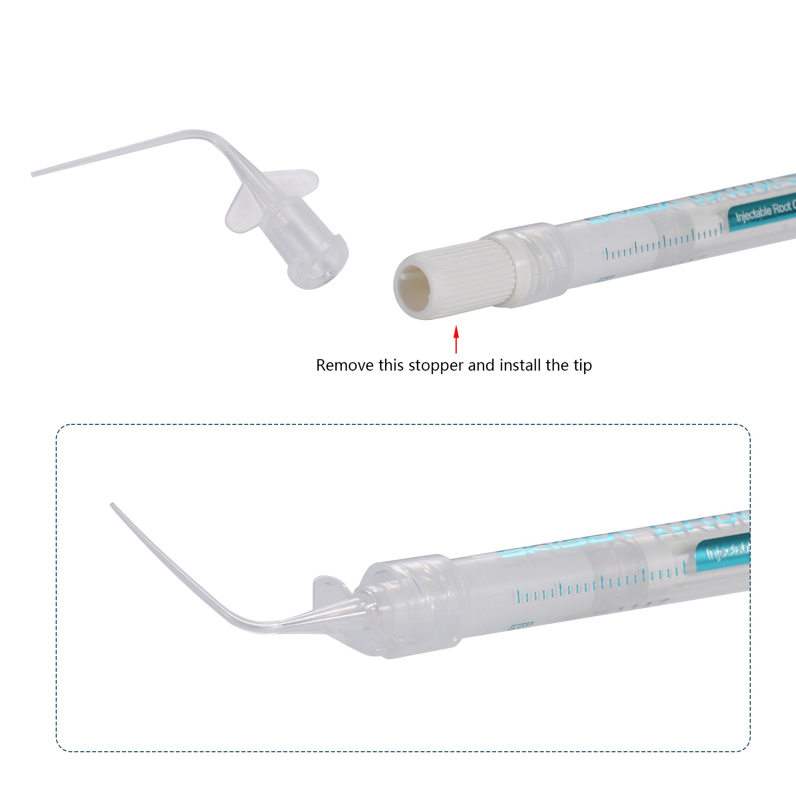 nRoot SP Injectable Root Canal Bioceramic Sealer 1g Syringe with Applicator Tips