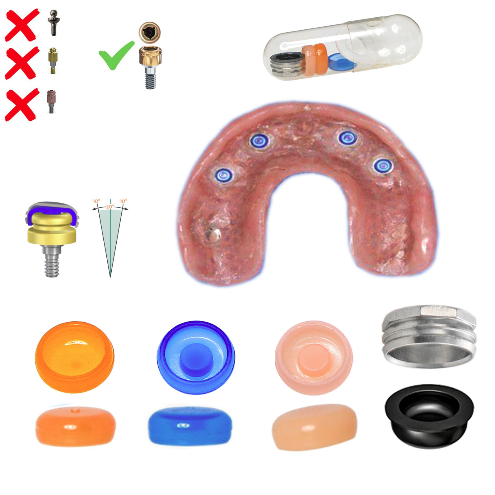 US Implans Overdenture Locator Abutment Replacement Retention Male Cap Inserts