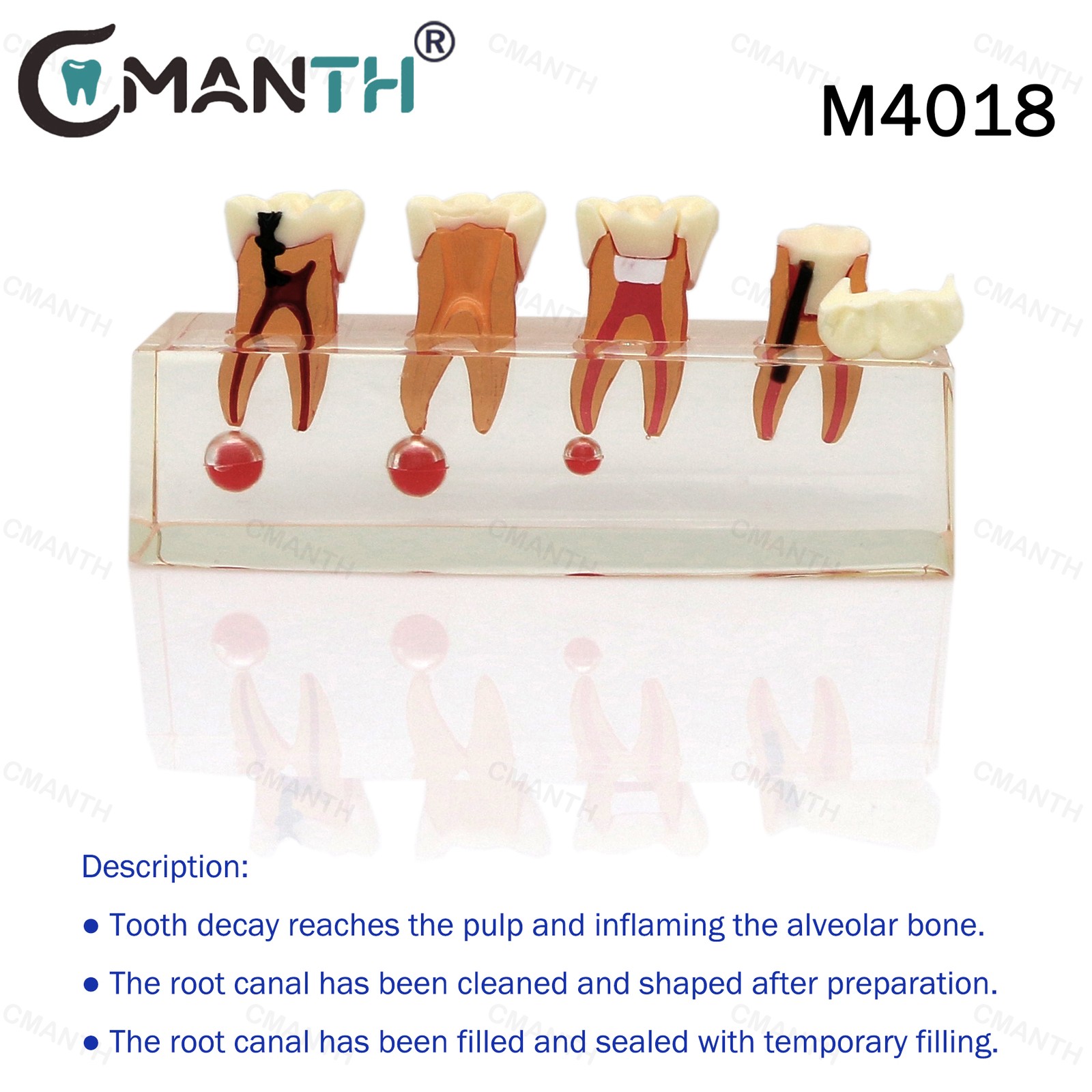 Dental Teeth Model Orthodontic Model Teaching Studying Implant Models Dental Lab