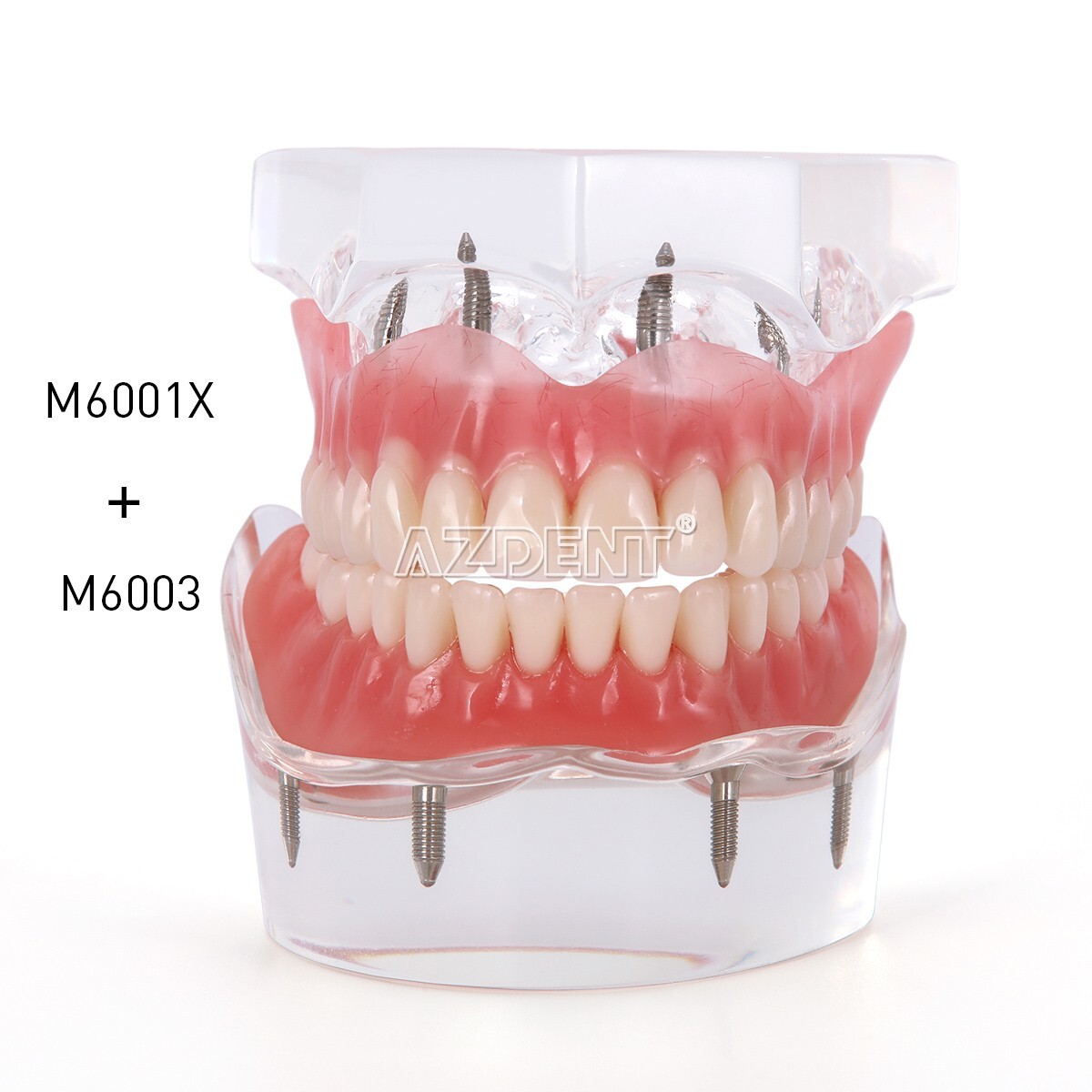 Kilgore NISSIN 200 Type Dental Typodont Model/Implant Denture Restoration Model
