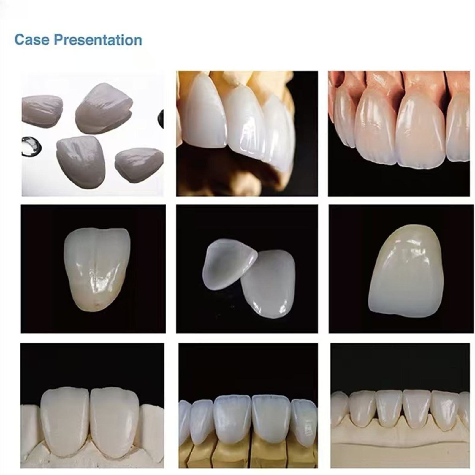 US C14 Dental Emax Glass Ceramic Blocks Lithium Disilicate CAD/CAM CEREC Block