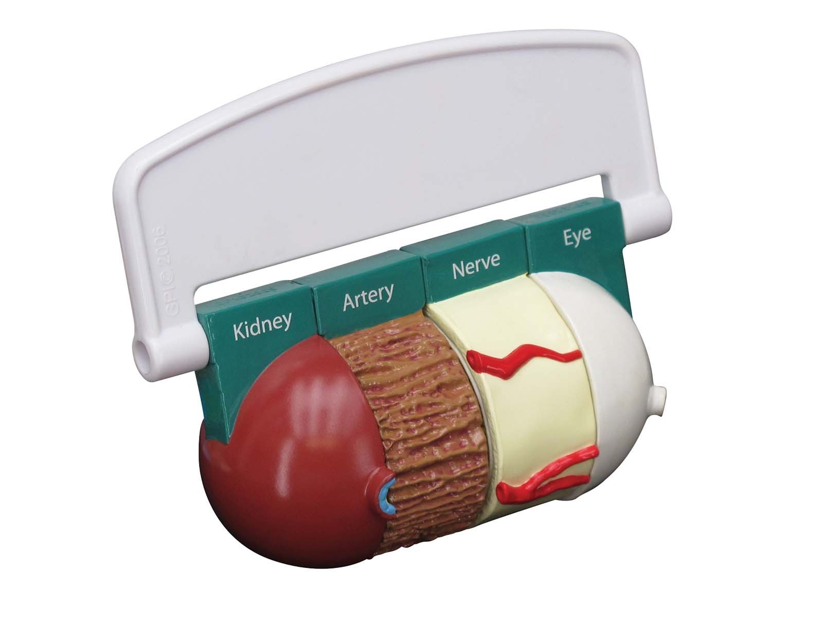 Diabetes 4-pc GPI Anatomical Model Set wKey LFA#4011 Make Us an Offer! SEE VIDEO