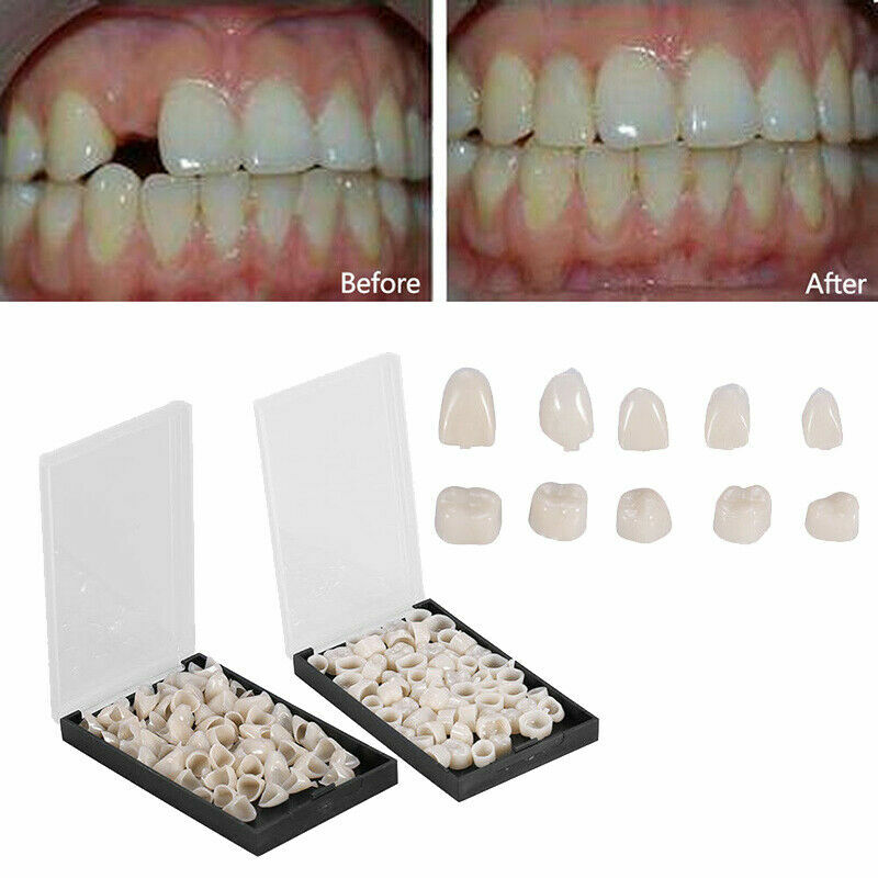 2 Types Temporary Crown Posterior Anterior Molar Resin Tooth Teeth Oral Dental
