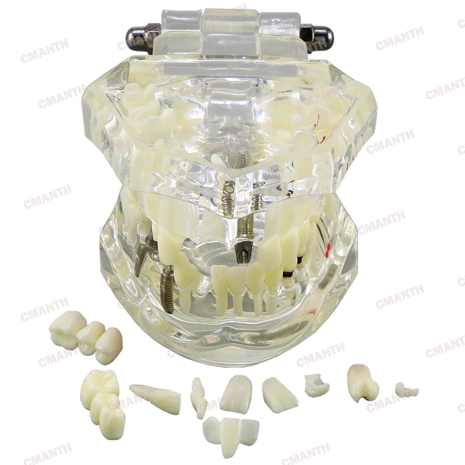 Dental Teeth Model Ortho Implant Practice Teaching of Implants Demo Model