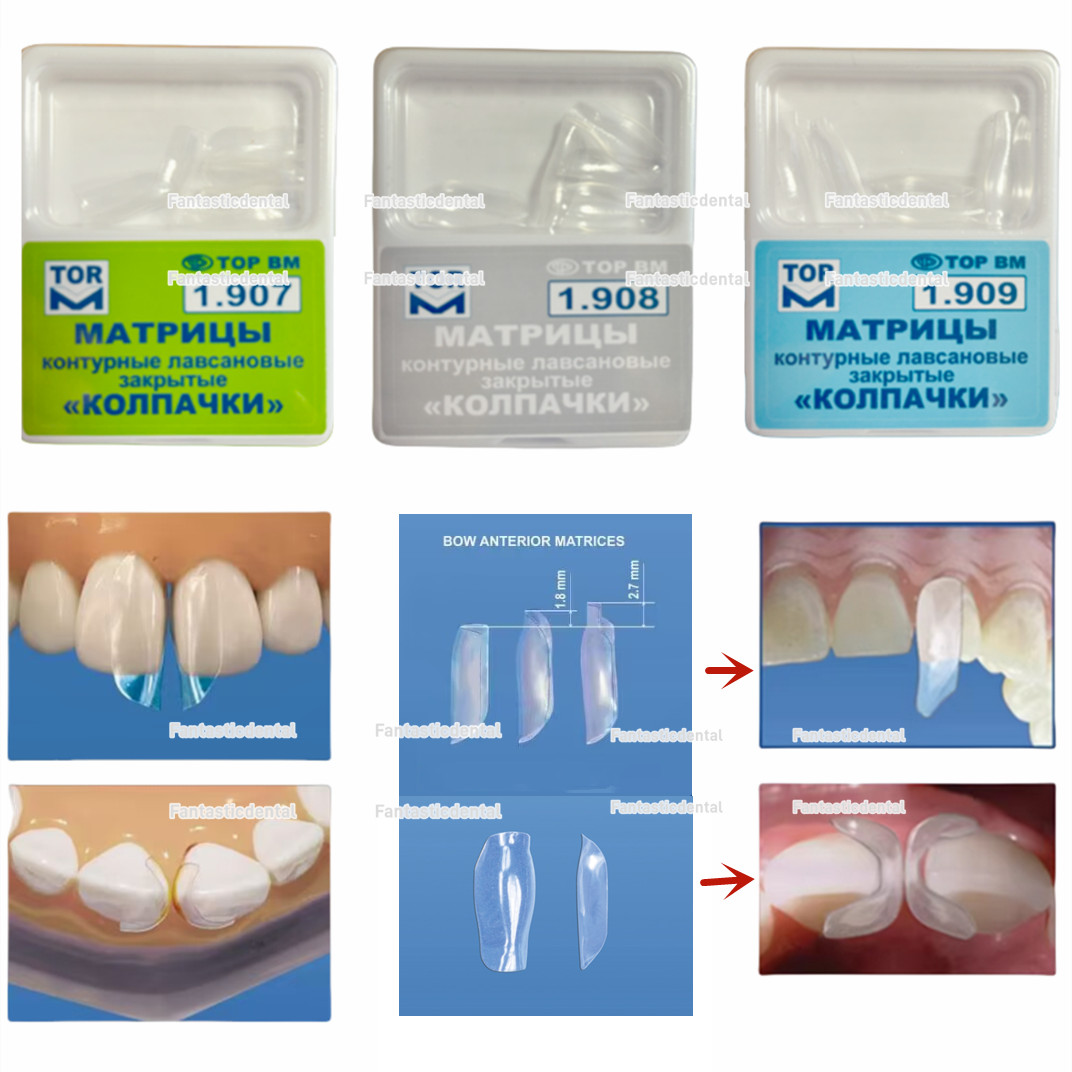 Dental Clear Matrix Transparent Anterior Matrices Bow Fit Bioclear L/M/S TOR VM