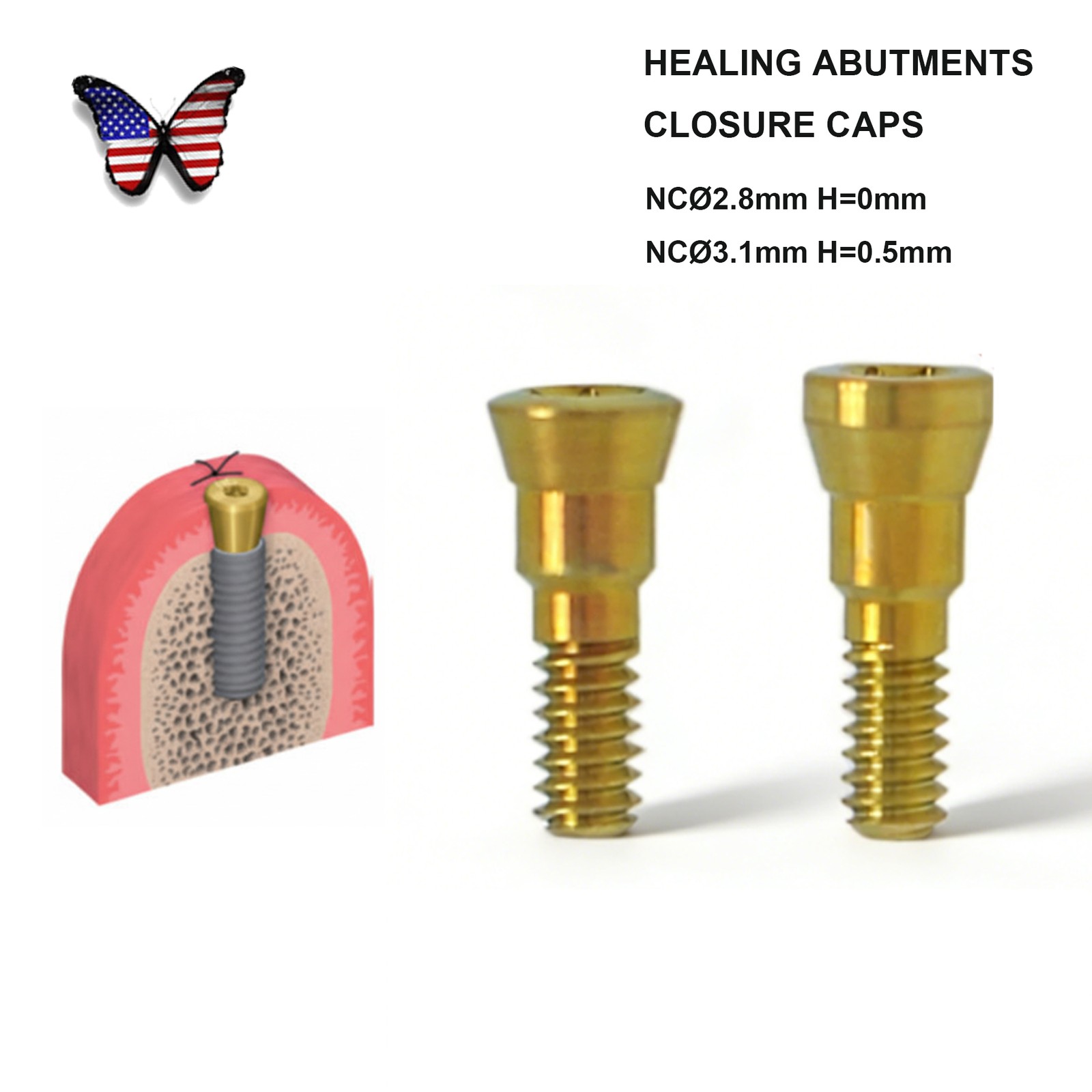 US Dental NC/RC Healing Abutment Closure Cap Bone Level Titanium Fits Straumann
