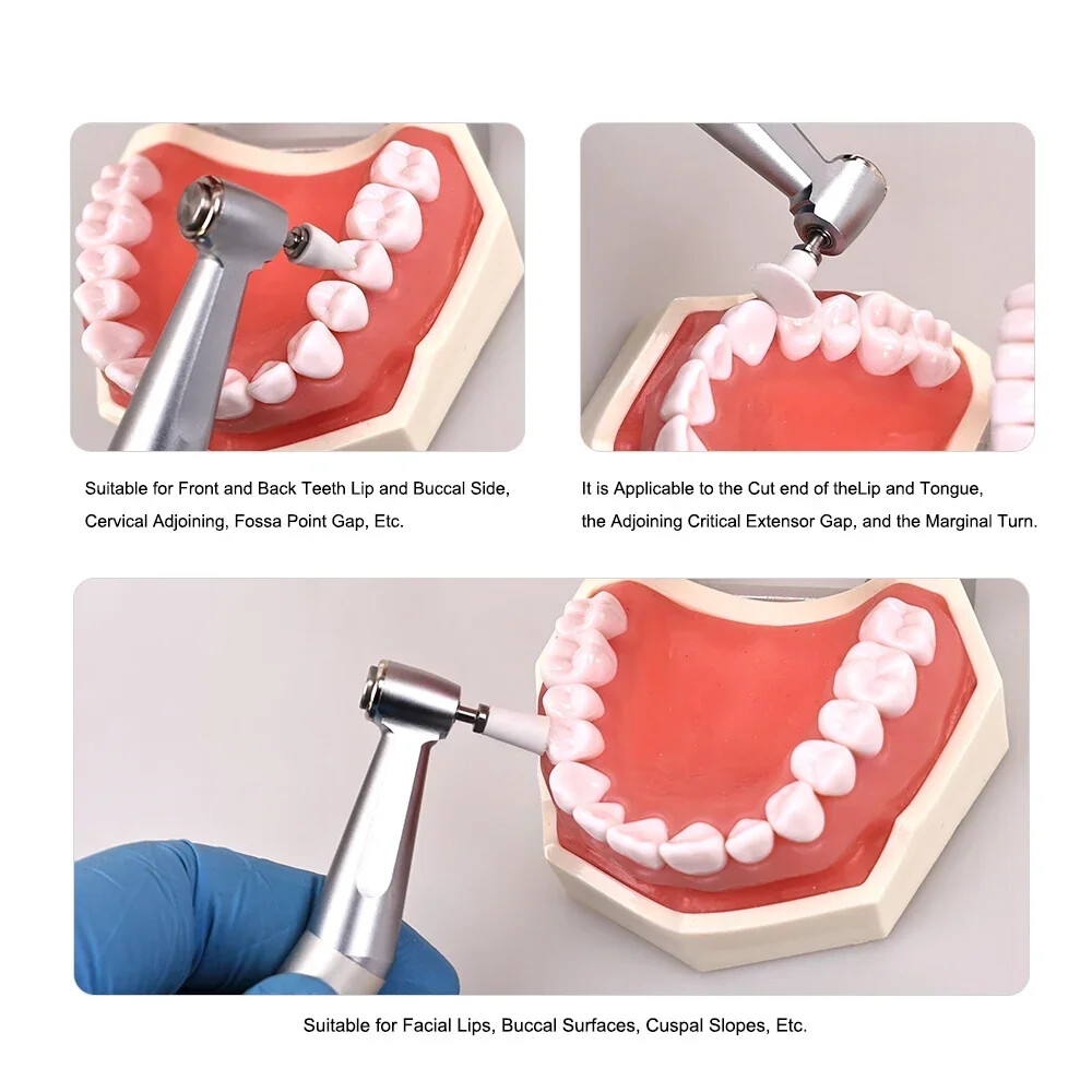 Dental Silicone Polisher For Finishing/Polishing Composite Restoration Temporary