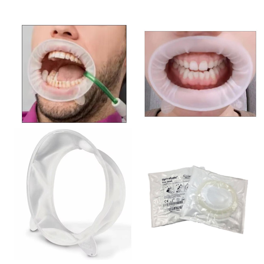 Ivoclar Vivadent Optragate Dental 3D Soft Lip Cheek Retractor Mouth Opener