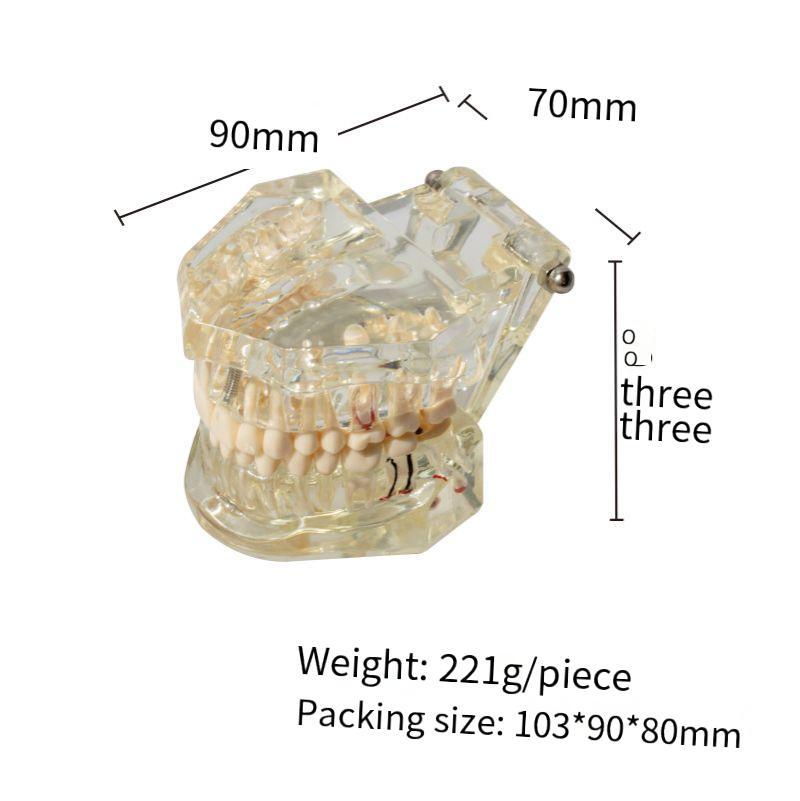 Dental Teeth Model Ortho Implant Practice Teaching With Implants Demo Model