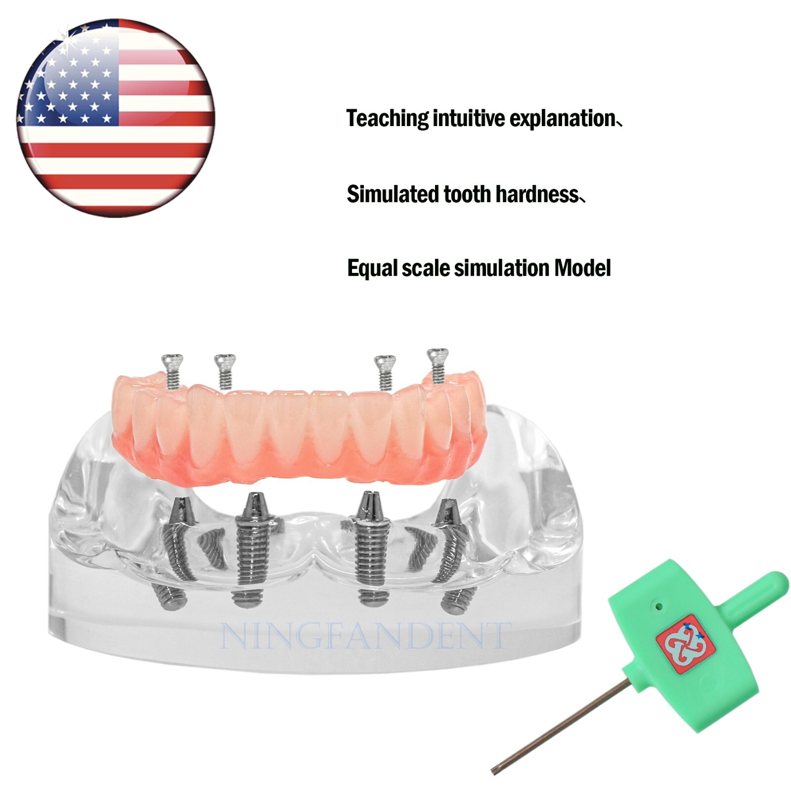 Dental All-on-4 Overdenture Implant Model, Upper/Lower Jaw-Clear,With 4 Screw