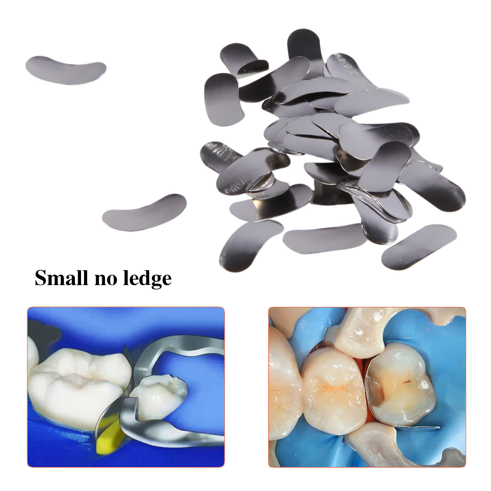 50Pcs/Pack Dental Metal Matrices Sectional Contoured Matrix Refill Hard Band ty