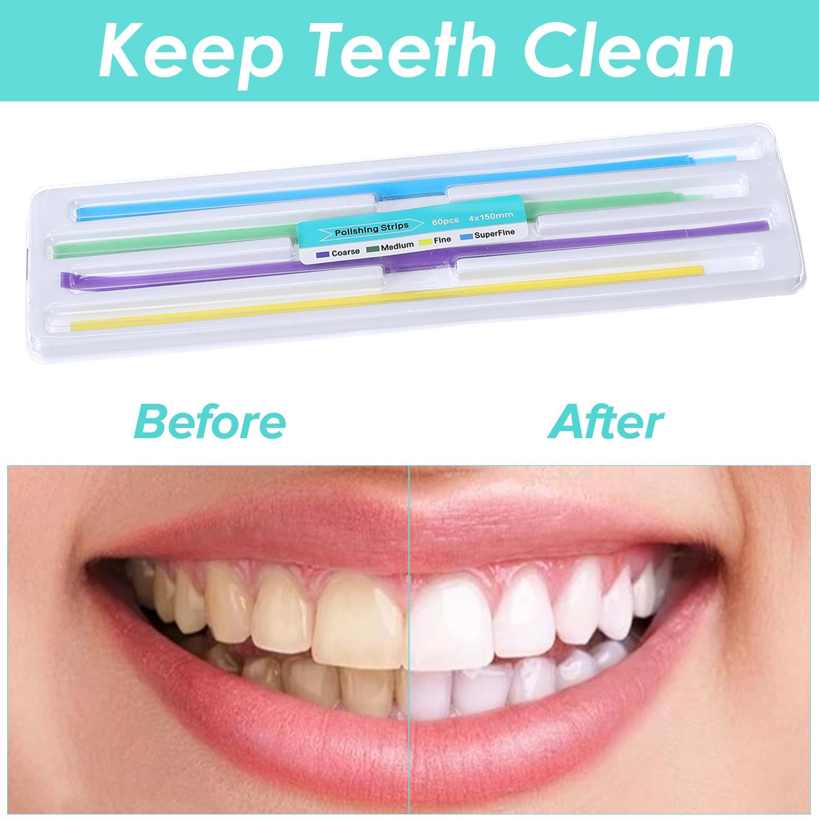 120pcs Tooth File for Chipped Tooth, Dental Sanding Strips, Dental Polishing …