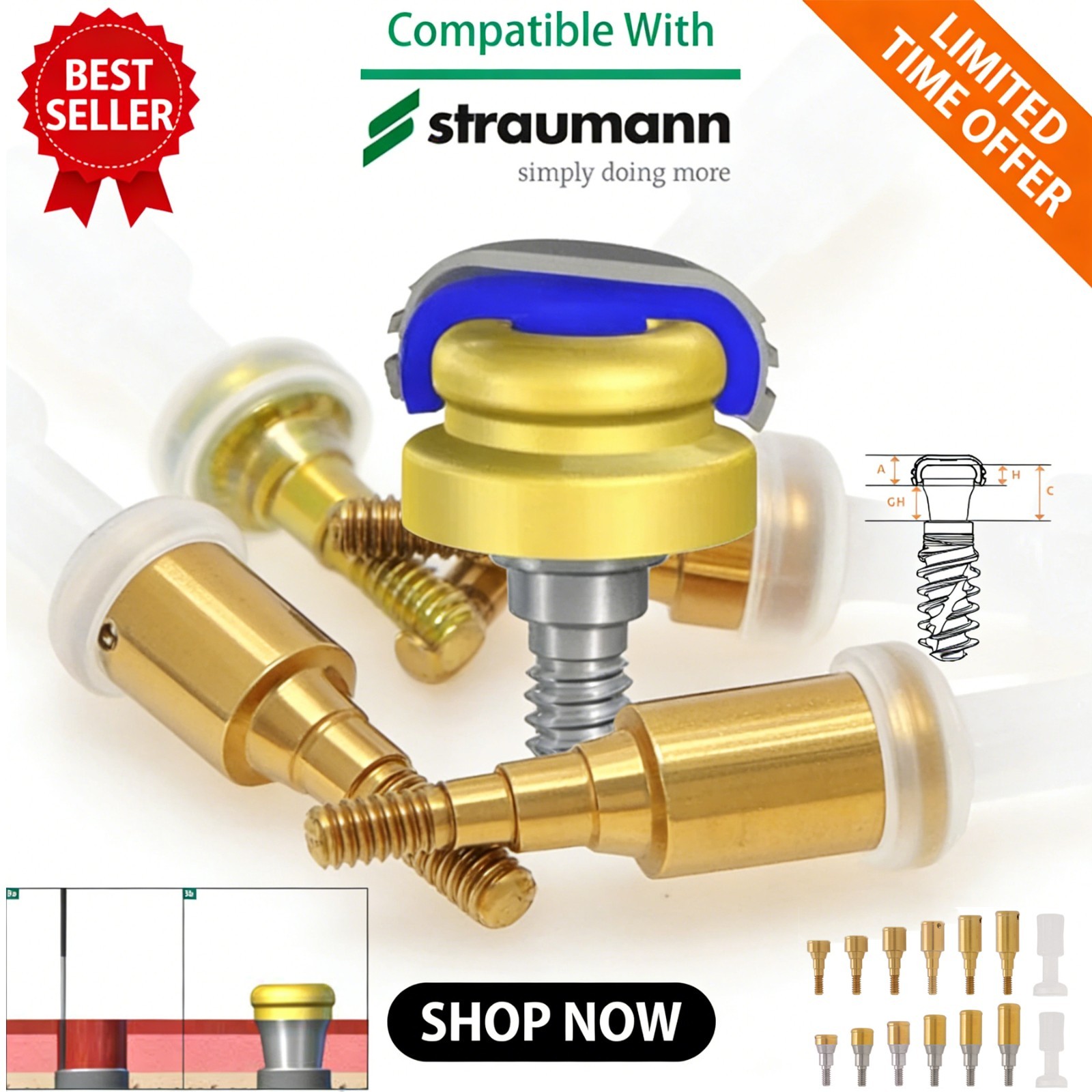 Titanium Locator Abutment Fit Straumann Bone Level NC/RC Zest Locator Compatible