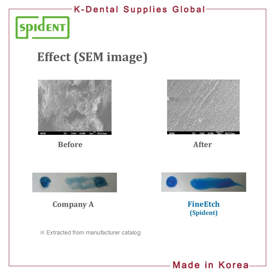 Spident FineEtch(37% Etching Gel) 5ml x 3ea