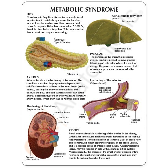 Metabolic Syndrome GPI Organ Model Set LFA#4020 Make Us an Offer! SEE VIDEO