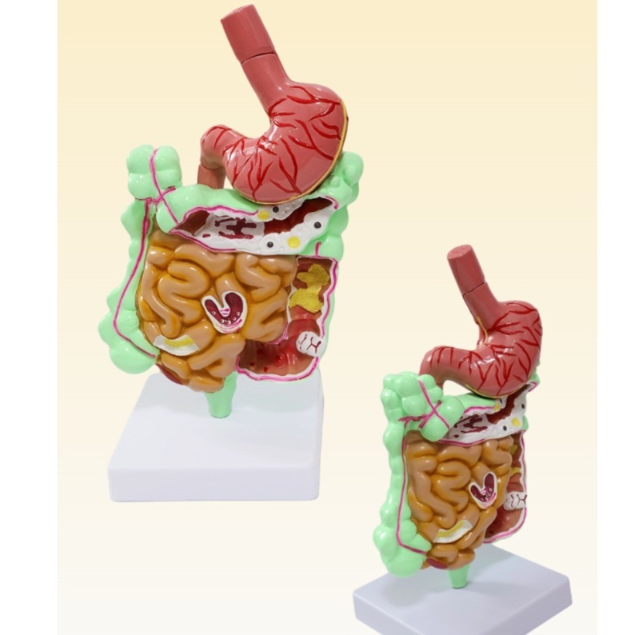 A 1PC Natural large intestine model, human stomach anatomy model
