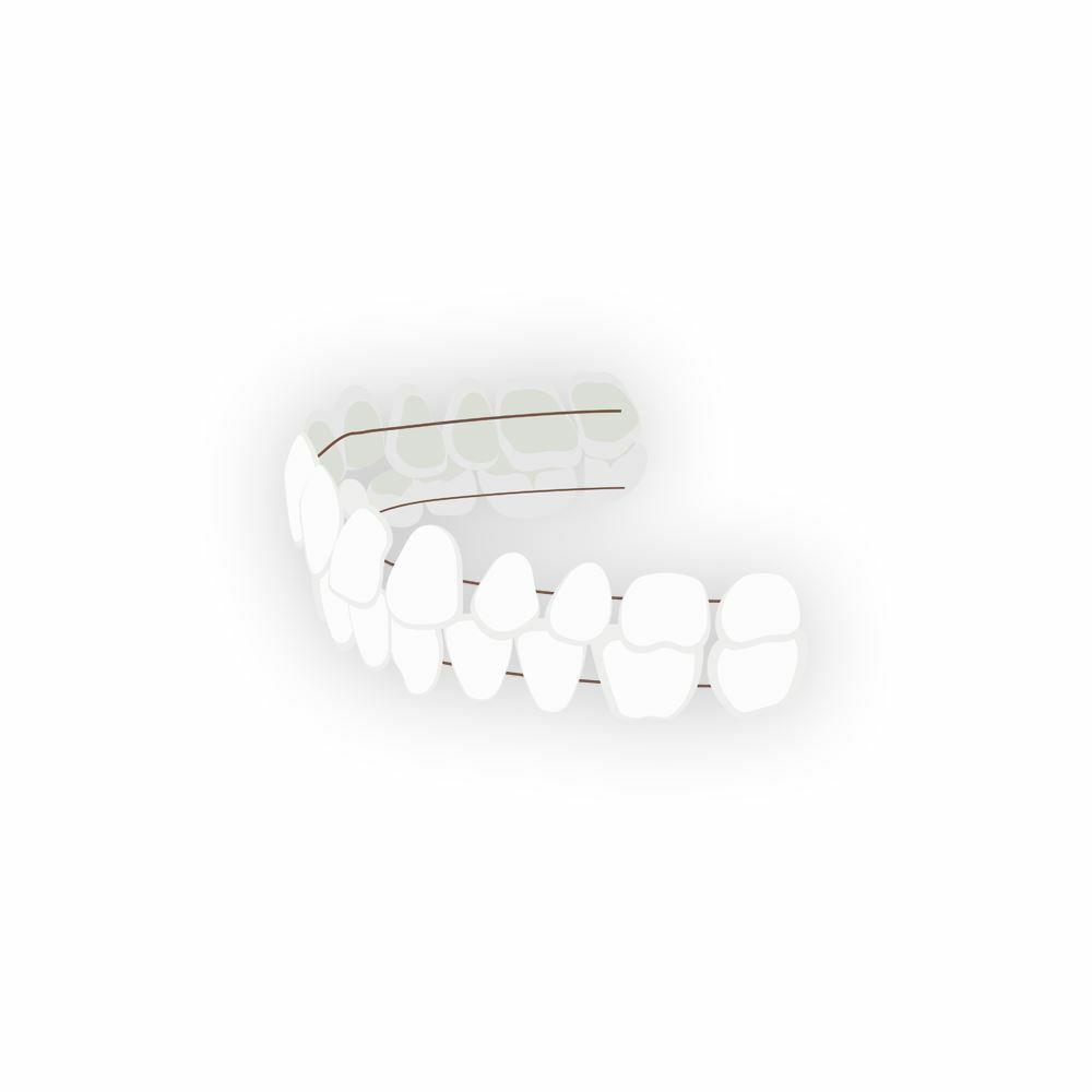 Synthetic Resin Novelty Teeth