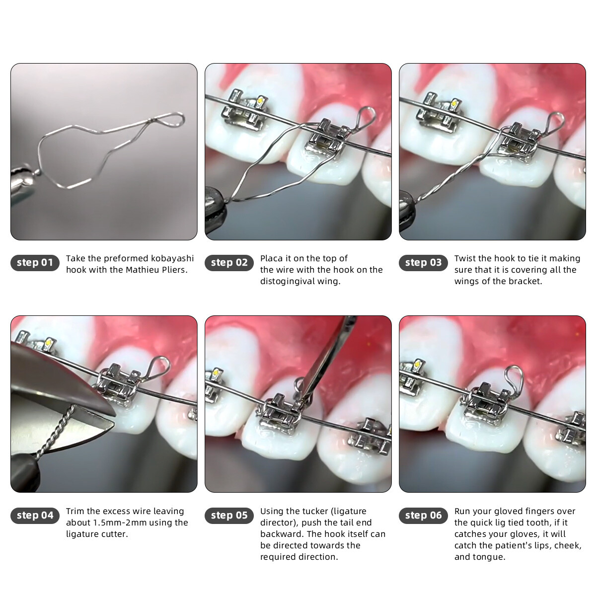 AZDENT Dental Orthodontic Wires Preformed Ligature Ties Long /Short/ Twist