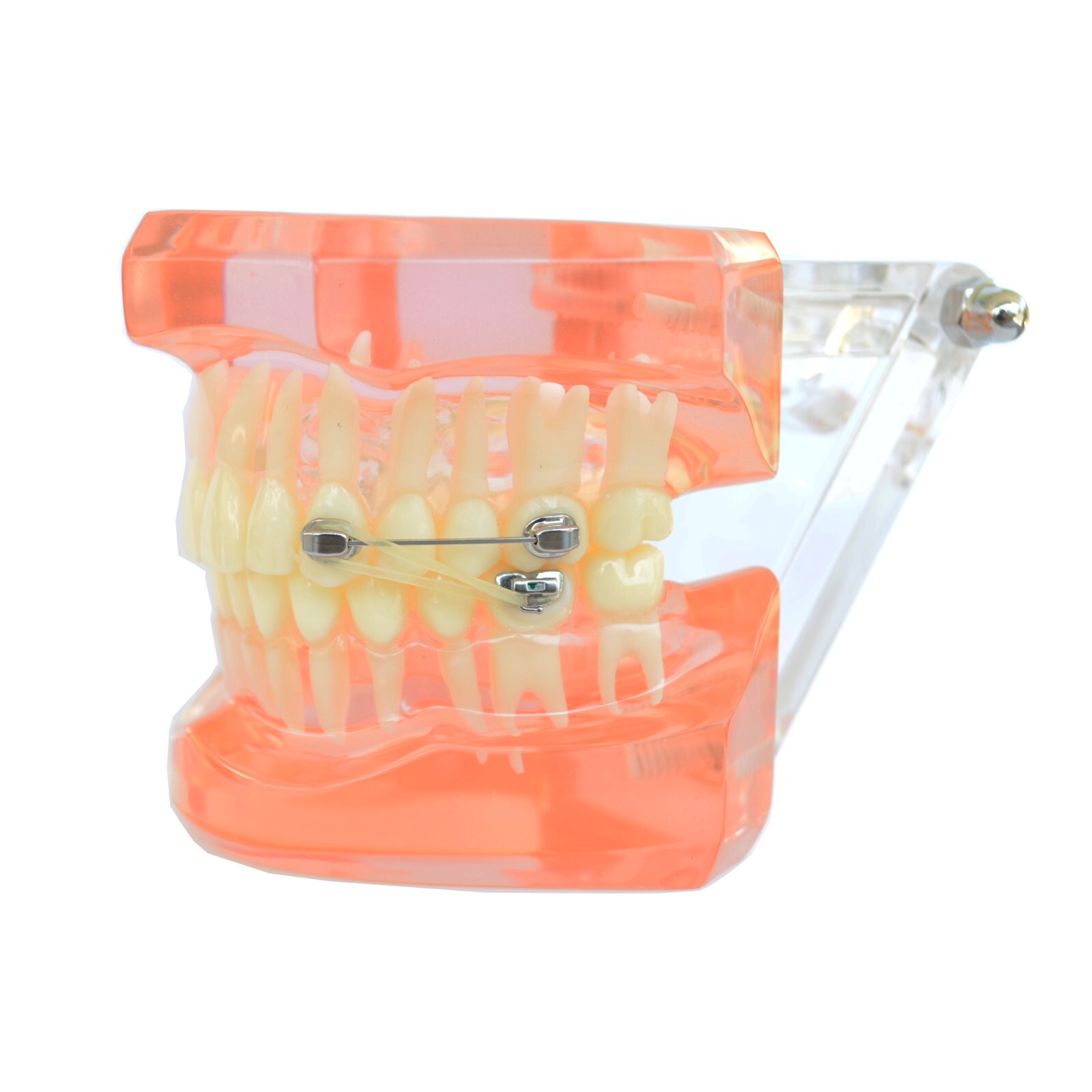 J&J™ Orthodontic BiteForce Distalizing Appliance Bondable Hooking Button (10/pk)