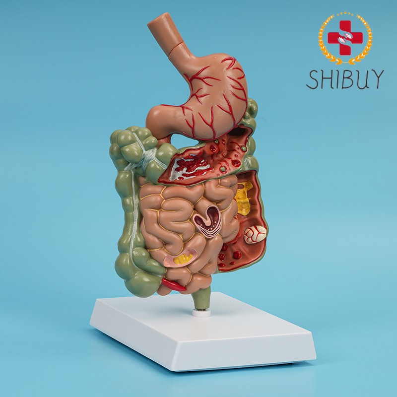 Digestive System Stomach Anatomy Small Large Intestine Colon Anatomical Model