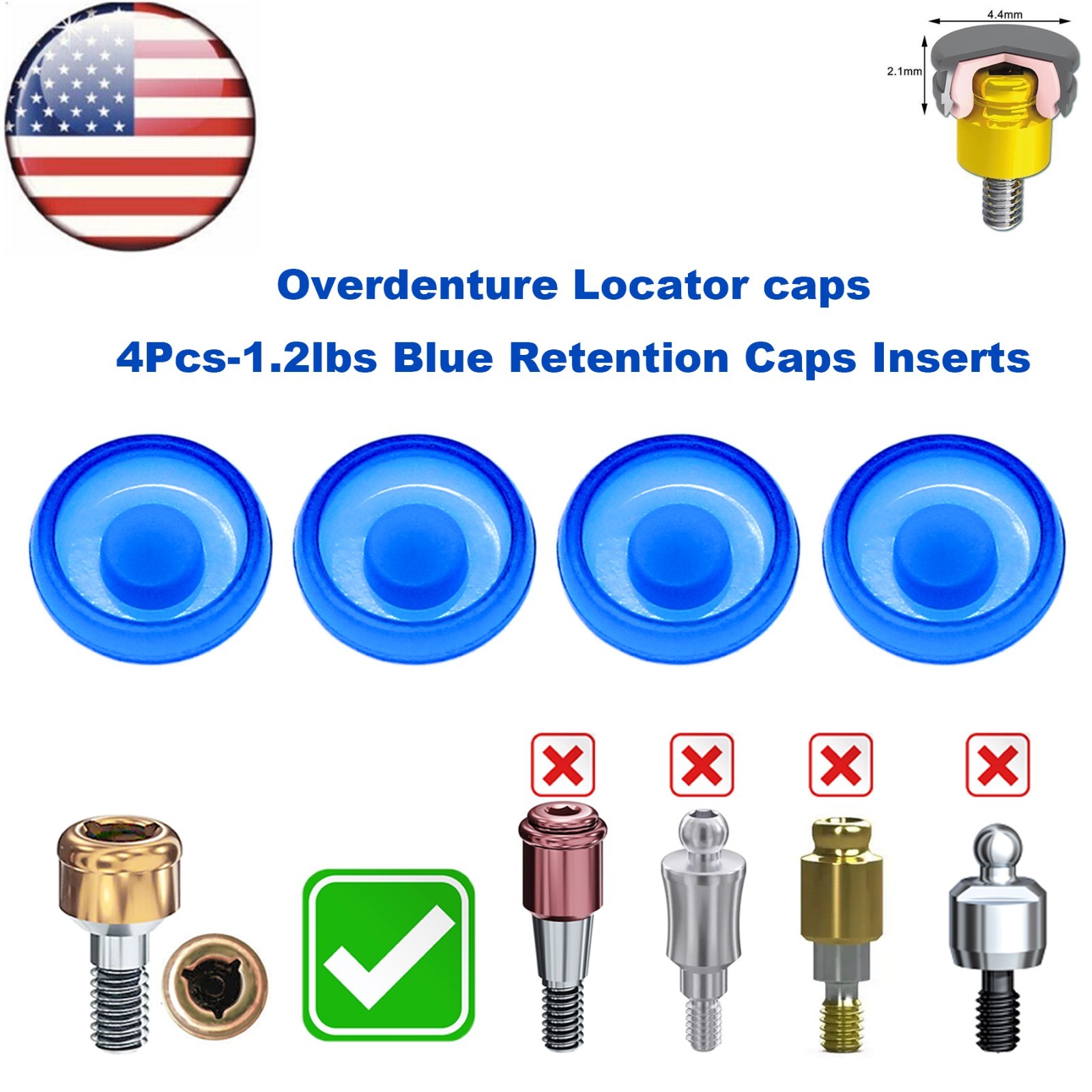 US Dental Overdenture Locator Universal Implant Retention Caps 1.2lbs Blue
