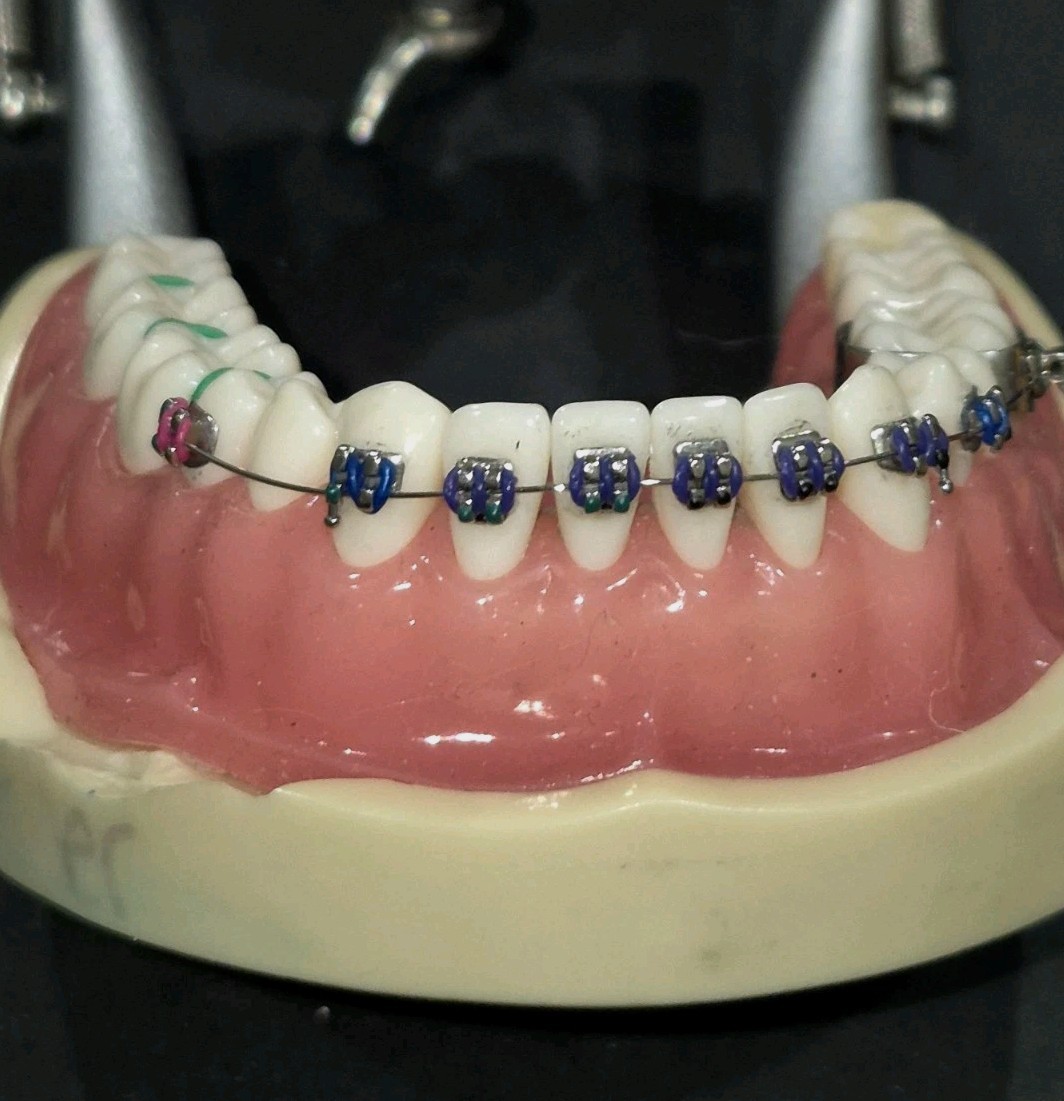 NISSIN PRO2001-UL-SP-DPM-32 Dental Typodont Model Teeth, With Braces See Photos