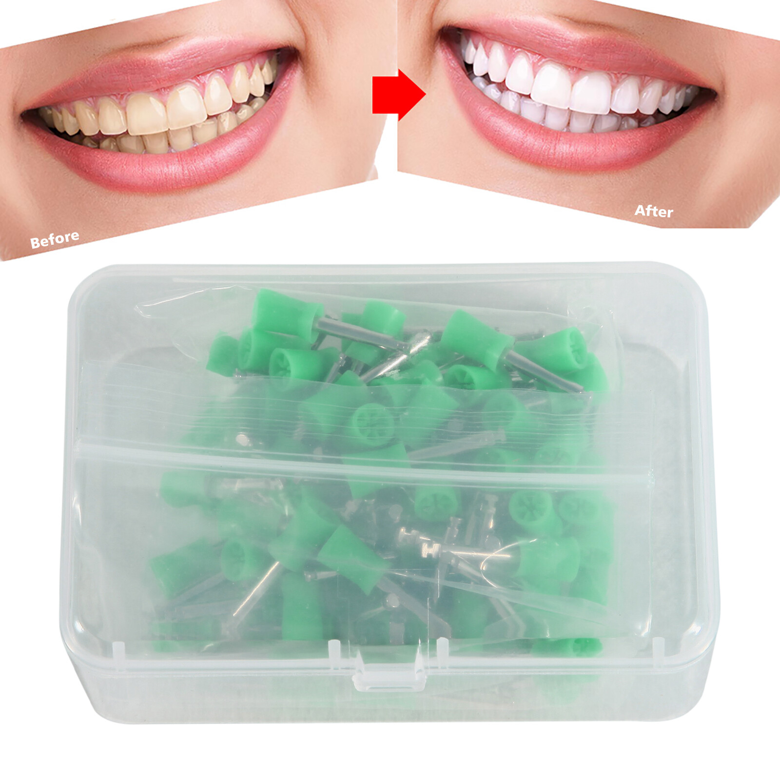 100 Pcs Dental Rubber Prophy Teeth Tooth Polishing Cups Brushes Latch TYPE Green