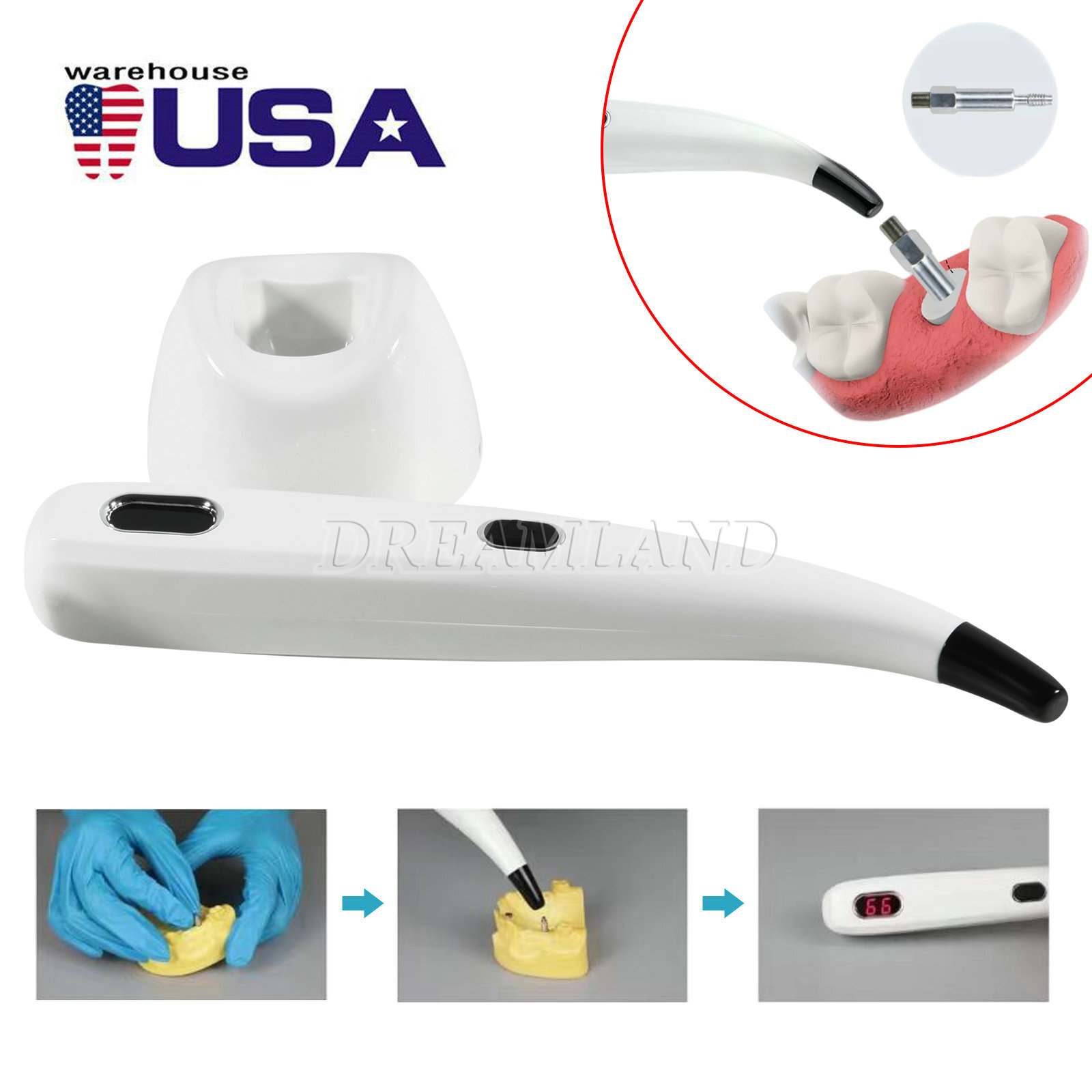 Dental ISQ Implant Stability Device Dental Implant Monitor Osseointegration SK