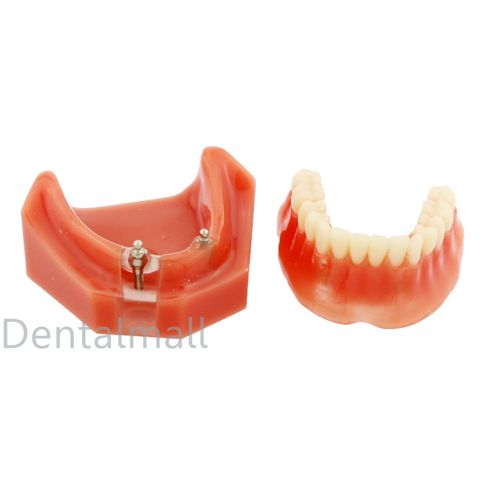 Dental Typodont Teeth Model Overdenture Implant Practice Endo Ortho Teachi Study