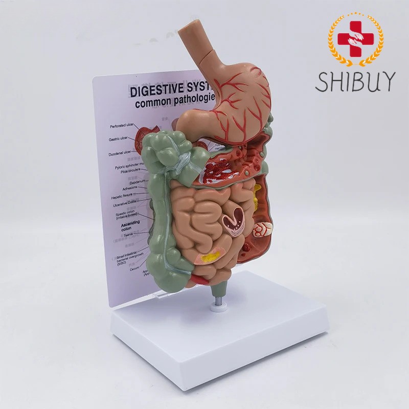 Digestive System Stomach Anatomy Small Large Intestine Colon Anatomical Model