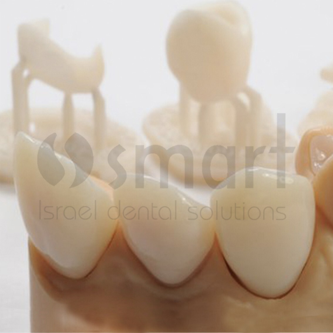 Detax Freeprint Crown 3D Printing permanent teeth 0.5L Long term bridge A2