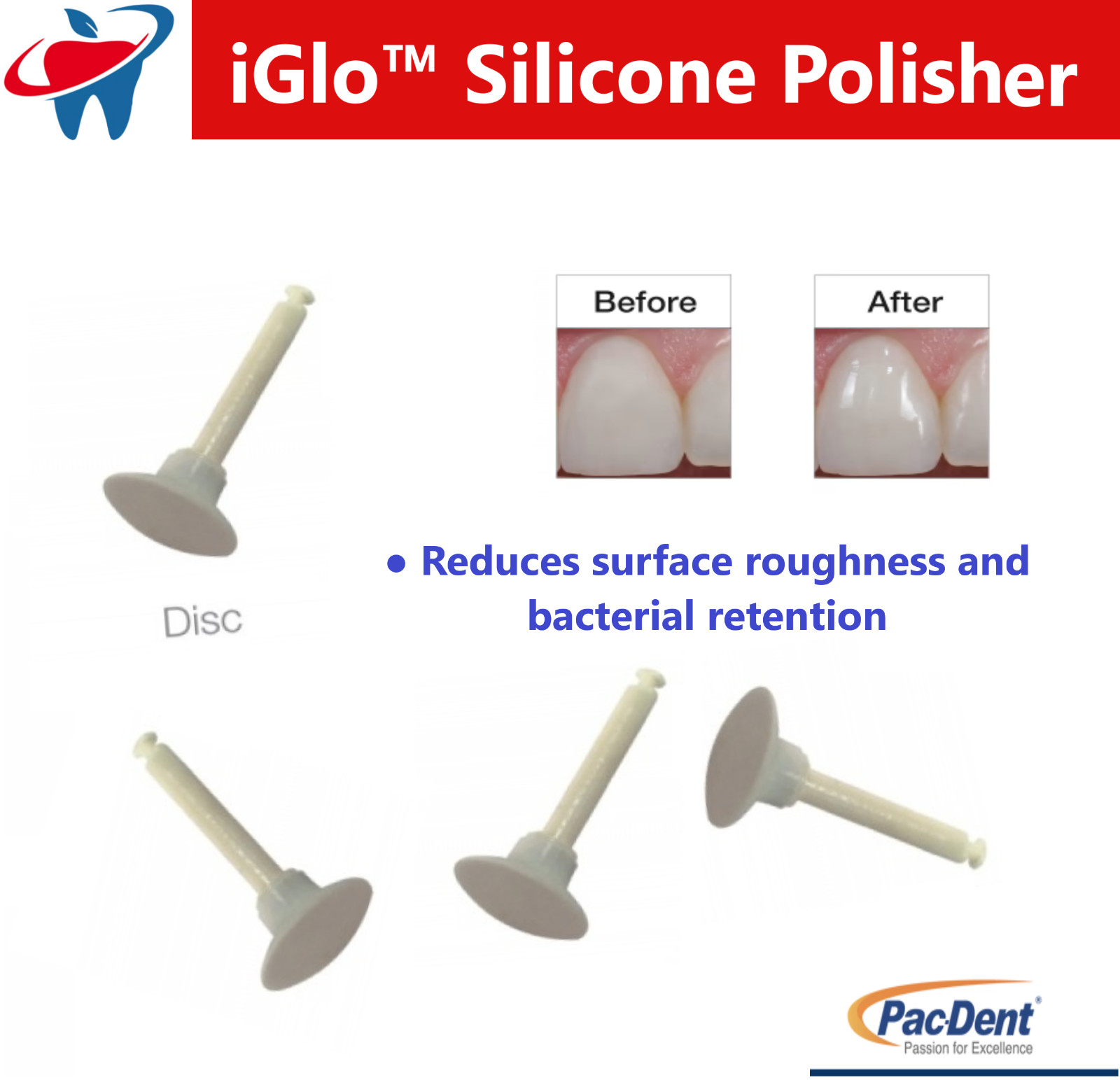 Dental Silicone Polisher Points Polishing for Composite Natural Teeth Porcelain