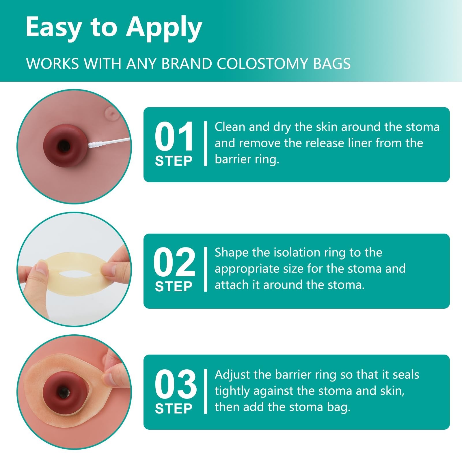Ostomy Barrier Rings – Outer Diameter 2″ (50mm) 4mm Thickness,Moldable Ostomy…