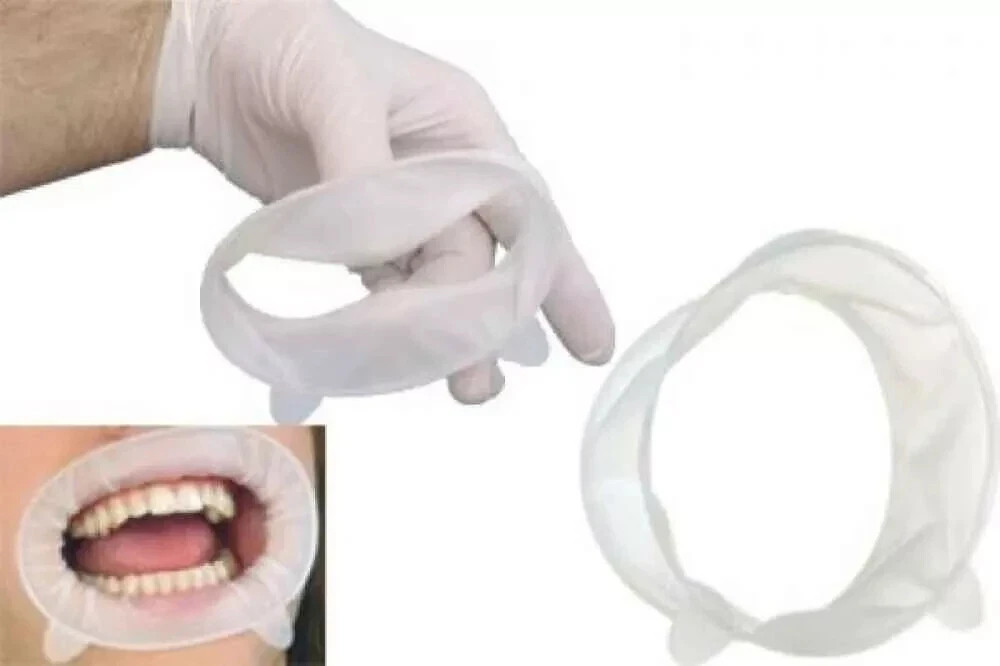 4 x Ivoclar OPTRAGATE 3D Mouth Opener Cheek & Lip Retractor All Sizes free ship