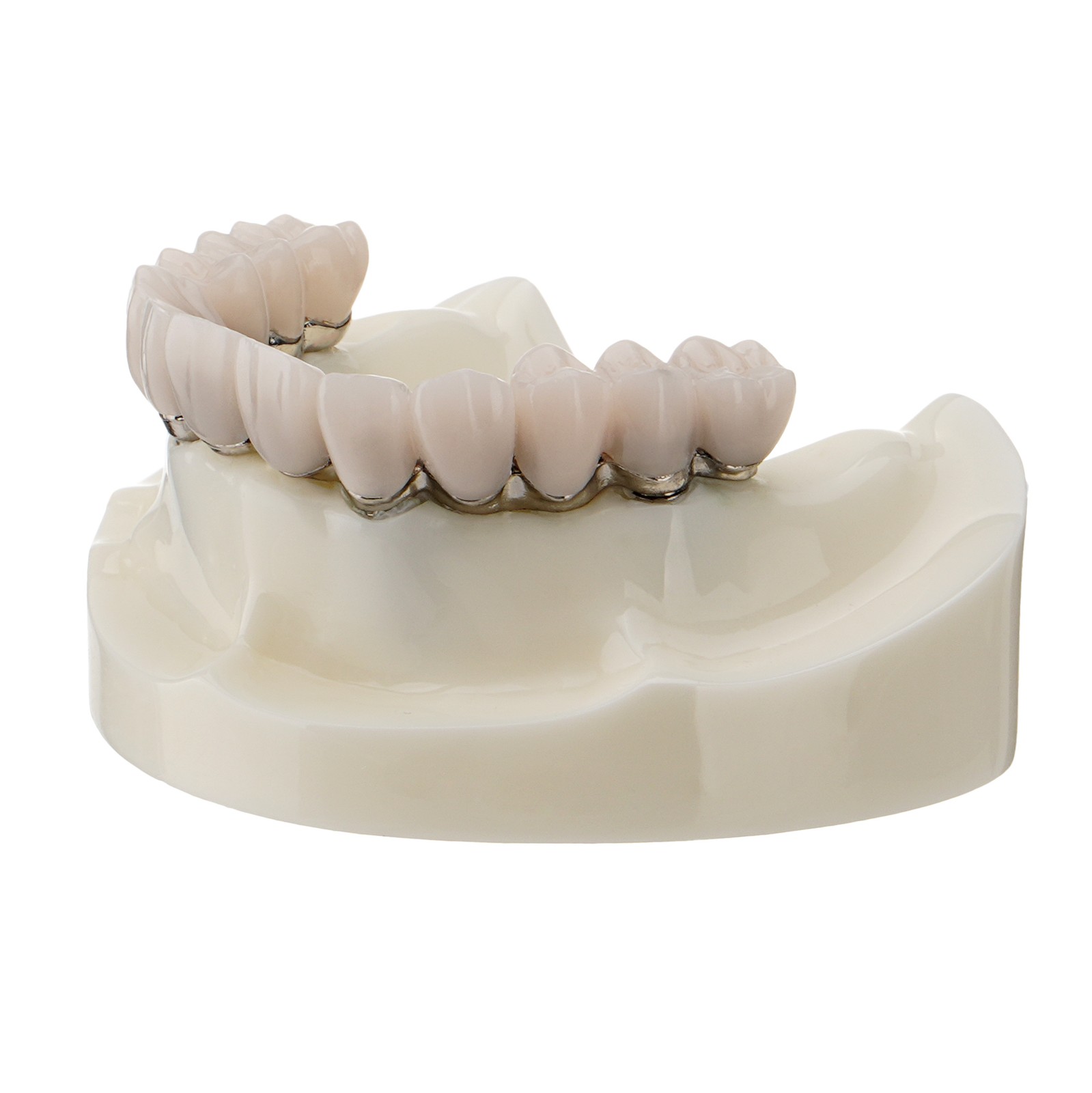 M6023 Dental All-on-4 Overdenture Model Upper Jaw Implants Restoration 4 Screws