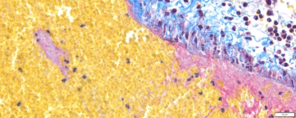 VitroView™ Martius Scarlet Blue (MSB) Stain Kit (Cat# VB-3036)