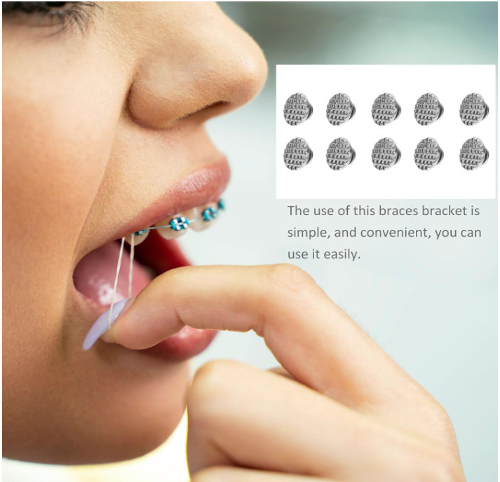 US Dental Ortho Lingual Buttons Bondable Round Mesh Base Metal/Ceramic Composite