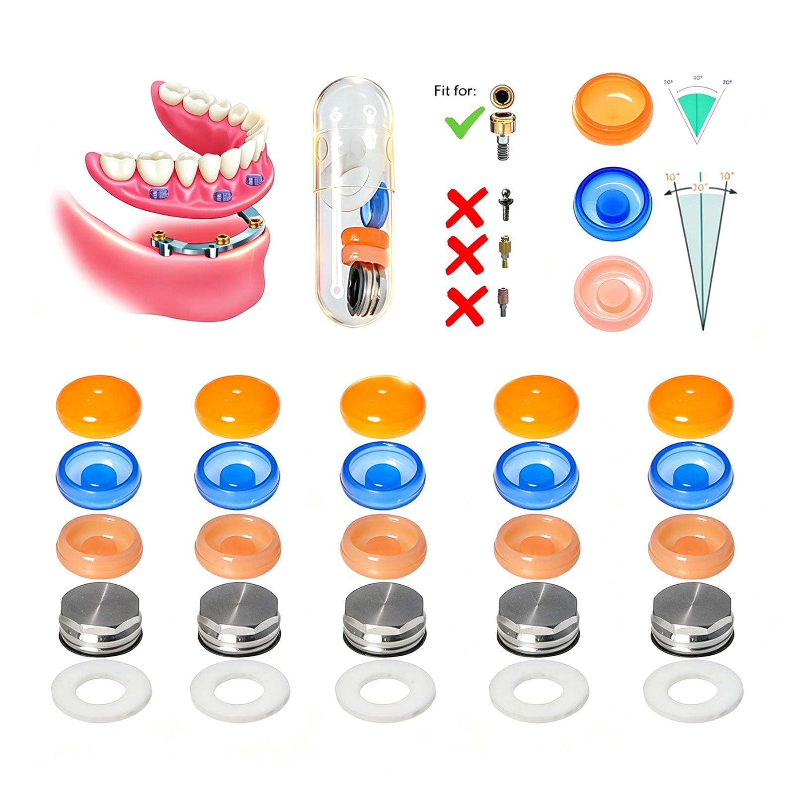 5Set Universal Overdenture Male Caps Retention Liners Fit ZEST Anchors locator