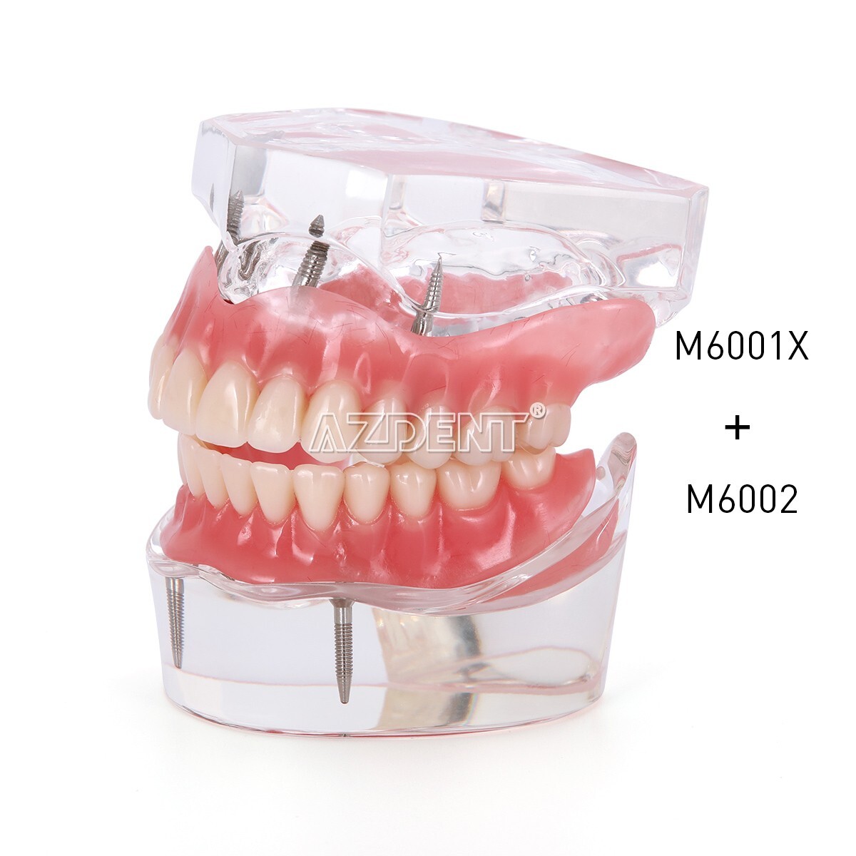 Kilgore NISSIN 200 Type Dental Typodont Model/Implant Denture Restoration Model