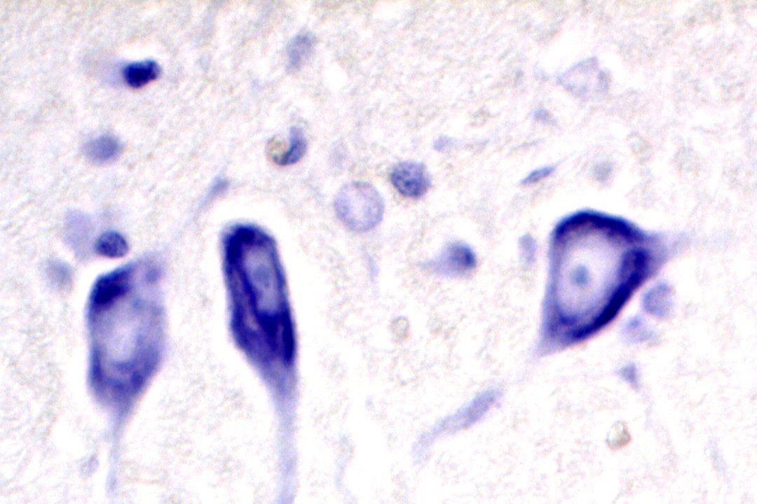 VitroView™ Nissl Stain Kit (Cat# VB-3010)