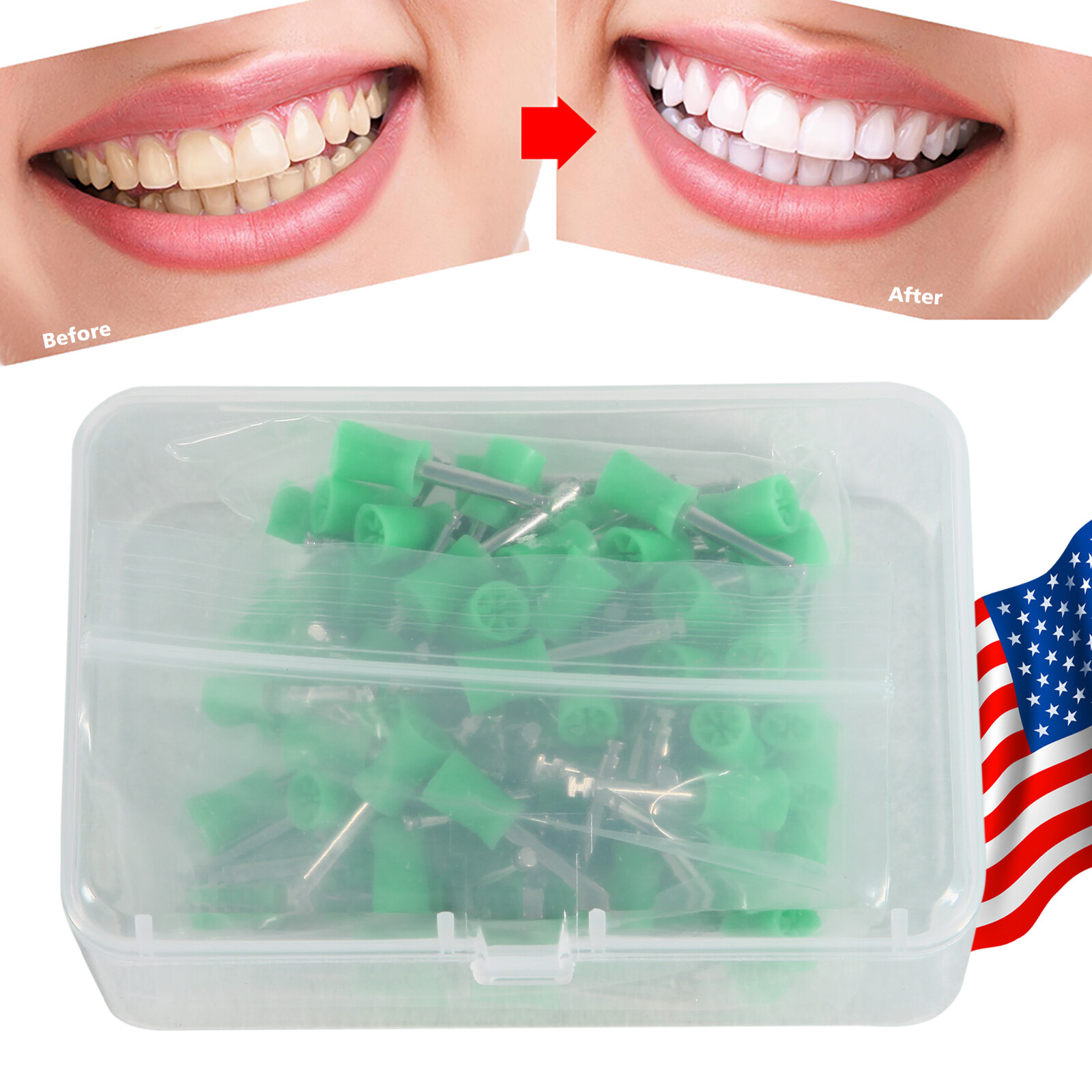 100Pcs Dental Polishing Cups Prophy Cup Latch Type Brushes Rubber Green