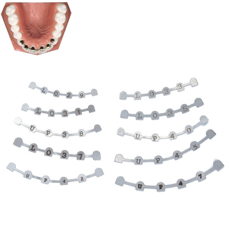 2/ Dental Lingual Retainer Bonding Upper Lower 3-3 With Mesh Universal