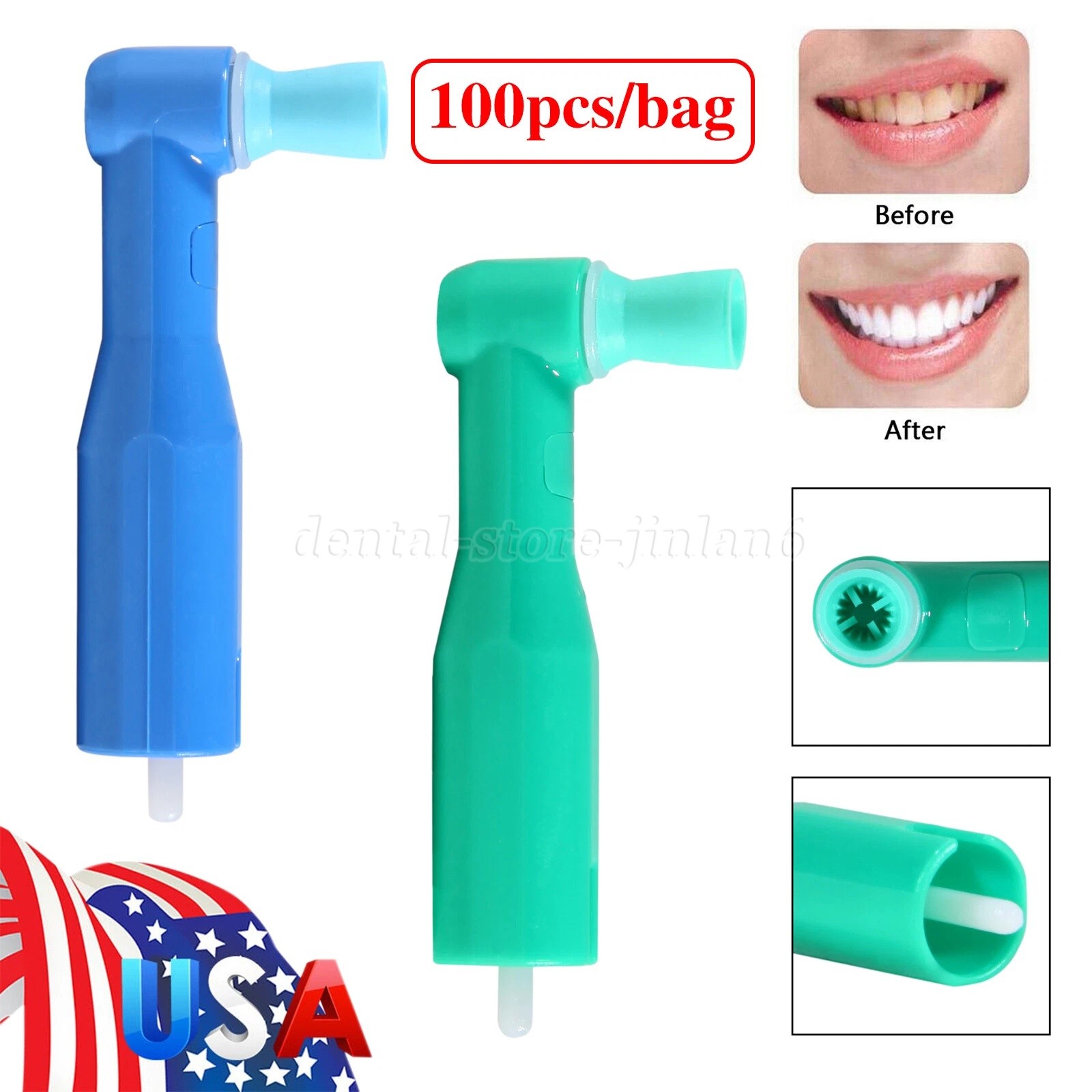 100-500* Dental Prophy Prophylaxis Angles Disposable Latex-Free Soft/Firm Cup ns