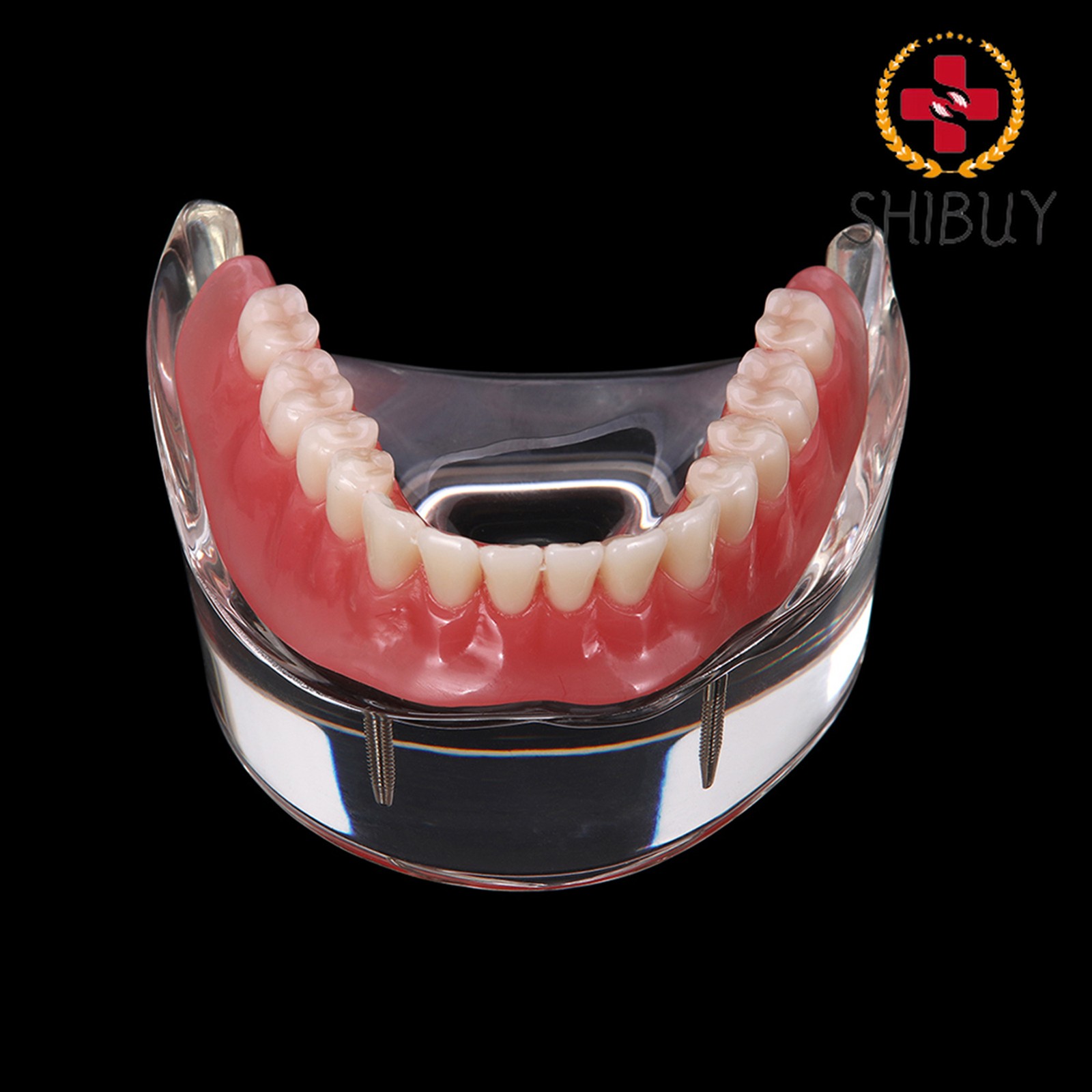 For Upper/Lower Teaching Study Dental Implant Model, Removable Overdenture