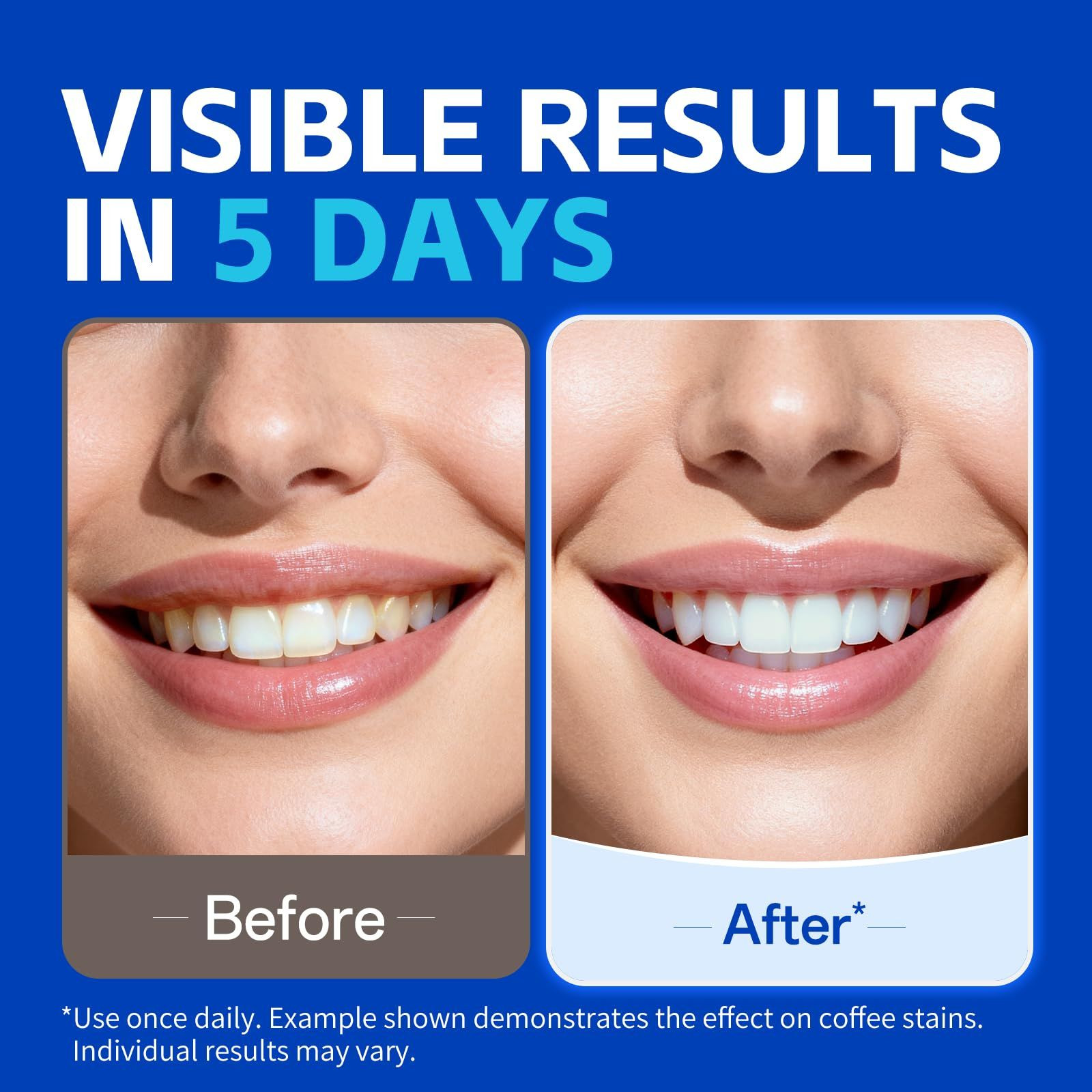 PERSMAX Teeth Whitening Strips – Professional 28 Count (Pack of 1), White