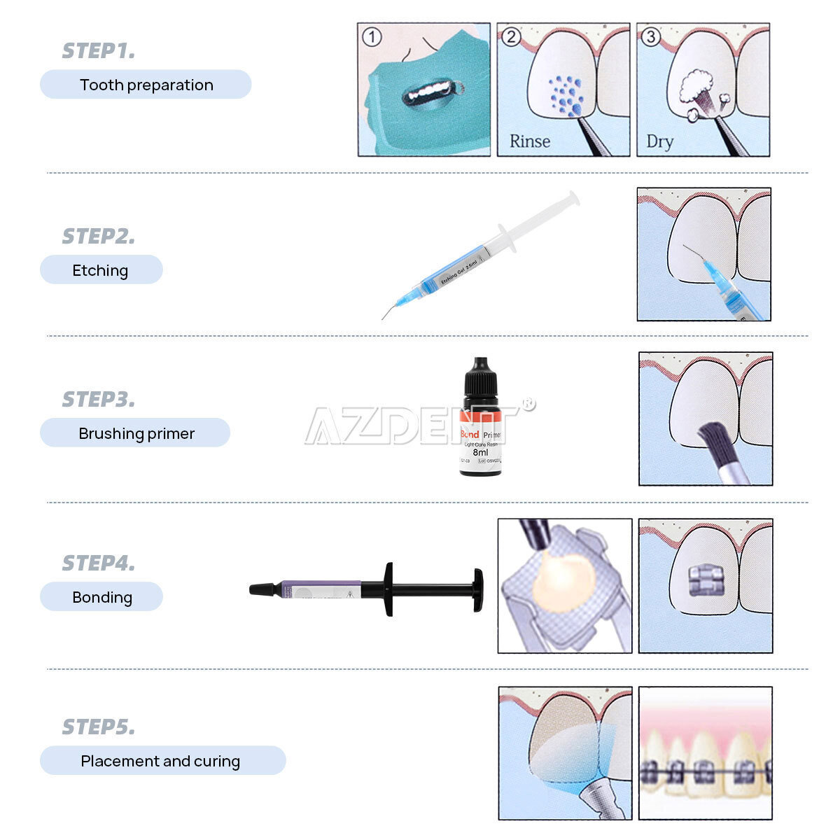 Dental Light Cure Bracket Braces Glue Ortho Primer Bonding Resin Composite Kit