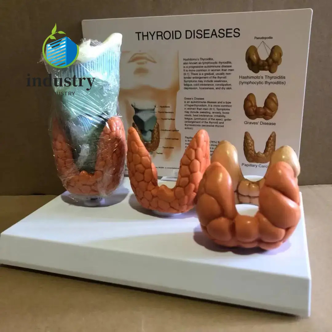 4pcs Set of Human Thyroid Pathological Anatomical Models Throat and Thyroid