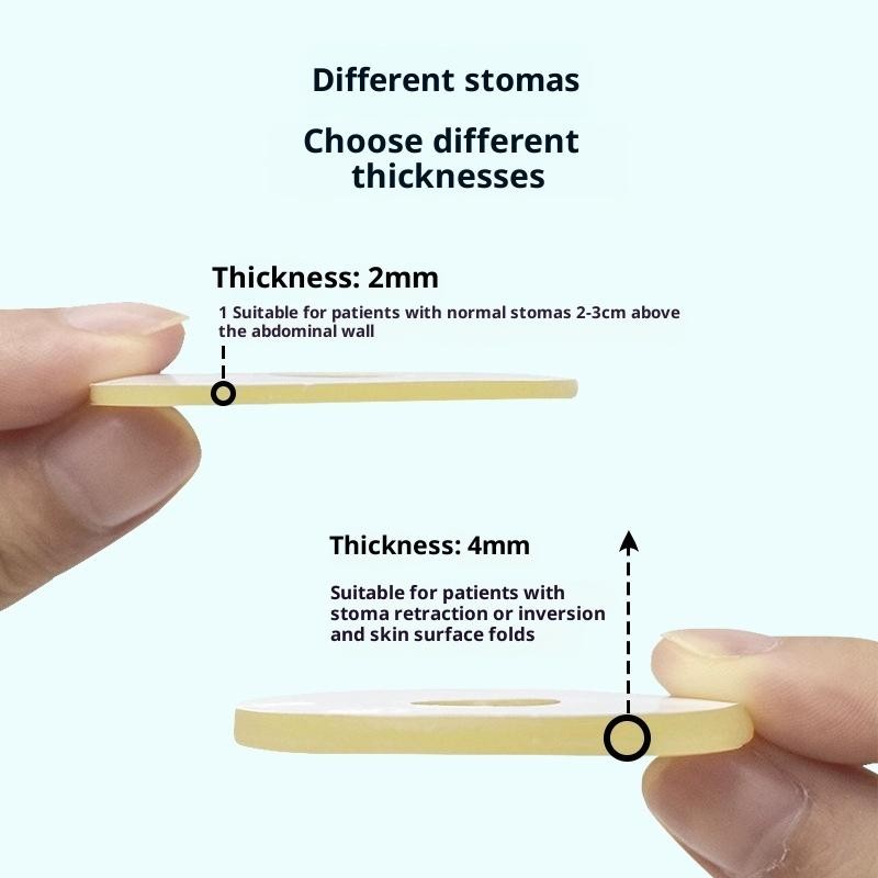 10Pcs Ostomy Paste Ring Baseplates Stoma Care Leak-Proof Ring For Ostomy